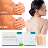 Fita de Silicone Gel Clareador Para Cicatriz (3 METROS) - ®SilconeScar