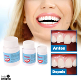 WhiteTeeth® - Resina Temporária Reparadora de Dentes