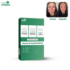 Mascara de Centella Natural Removedora de Cravos, Acne e Poros - CentellaMask®
