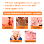 Bastão Removedor de Calos e Rachaduras (SUPER HIDRATANTE) BabyFeet®
