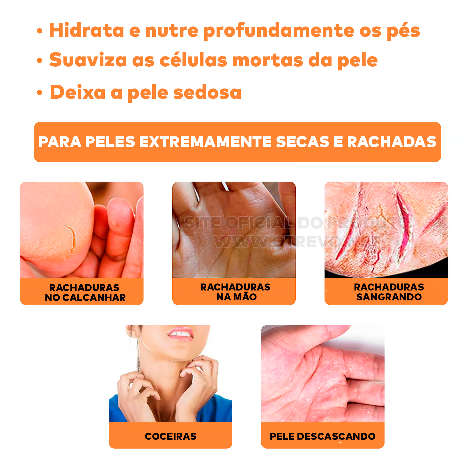 Bastão Removedor de Calos e Rachaduras (SUPER HIDRATANTE) BabyFeet®