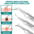 Pinças Super Skin - Kit Removedor de Cravos e Espinhas (3 Peças)