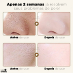 Gold Mask®  - Máscara Coreana Antienvelhecimento de Retinol Puro