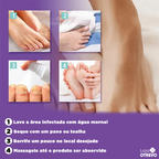 Spray Reparador de Unhas 3 em 1 (Reparador, Restaurador e Fortalecedor de Unhas) MedNail®