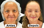 Máscara de Efeito Peeling Natural Puro Colágeno - NewFace®