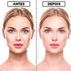 10 Máscaras Invisíveis Para Esticar Rosto - Anti-rugas Com Ácido Hialurônico E Elevação Microcristalina