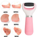 Removedor de Calos Profissional Portátil - CalurRemover® (REMOVE 100% DOS CALOS E RACHADURAS)