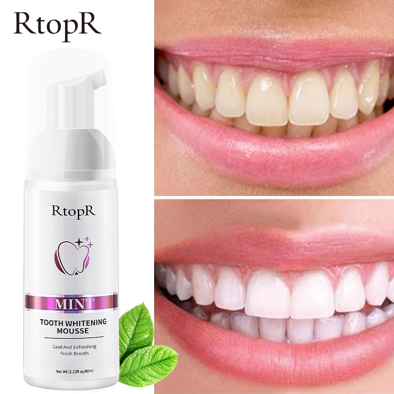Super Clareador Dental e Removedor de Manchas -®RtopR