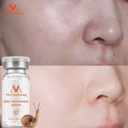 Redutor de Poros, Manchas Baba de Caracol - ®Nailmax