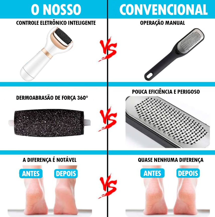 Removedor de Calos Profissional Portátil - CalurRemover® (REMOVE 100% DOS CALOS E RACHADURAS)