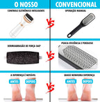 Removedor de Calos Profissional Portátil - CalurRemover® (REMOVE 100% DOS CALOS E RACHADURAS)