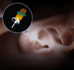 Limpador de Orelha com LED ®BabyCleaner (Lançamento)