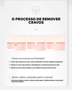 Removedor de Cravos Lanbena + 60 Adesivos Aplicadores (Brinde) 2 em 1